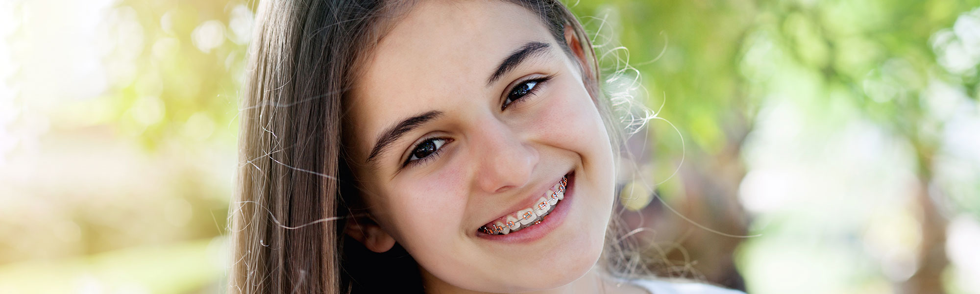Metal Braces Oxnard CA